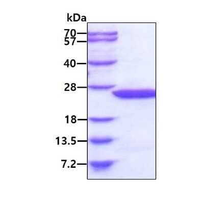 SDS-PAGE: Recombinant Human MDP1 His Protein [NBP1-50907]